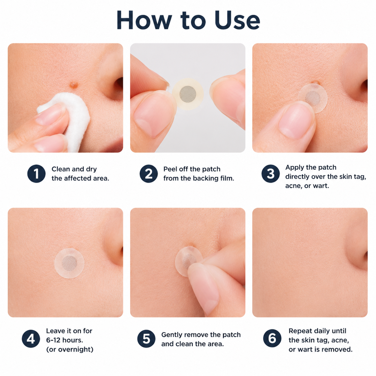 🔥Curalona®2-in-1 Microneedle & Hydrocolloid Patch🍀| Removes Raised Moles, Acne, Flat Warts & Skin Tags | Helps Improve Wrinkles, Scars & Blemishes | Invisible Patches for Face & Body