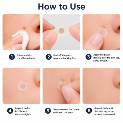 🔥Curalona®2-in-1 Microneedle & Hydrocolloid Patch🍀| Removes Raised Moles, Acne, Flat Warts & Skin Tags | Helps Improve Wrinkles, Scars & Blemishes | Invisible Patches for Face & Body