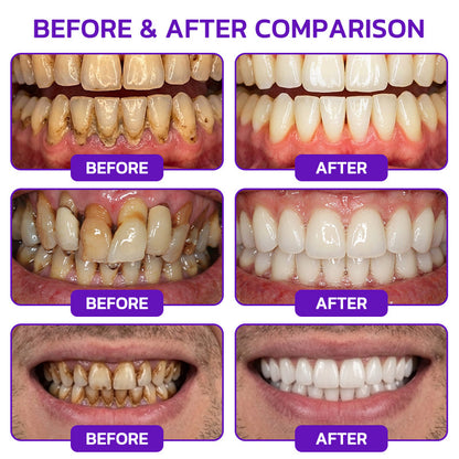 Purelora® VioCore Bee Venom Gingivitis & Periodontitis Treatment Toothpaste