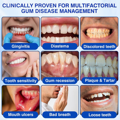 🏅🦷🛡️Purelora® GumRevive Periodontal Repair Gel