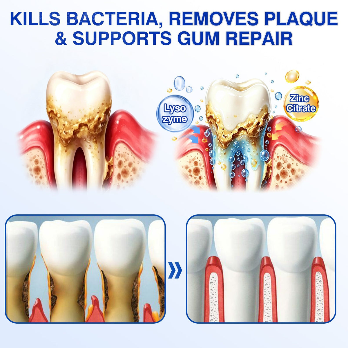 🏅🦷🛡️Purelora® GumRevive Periodontal Repair Gel