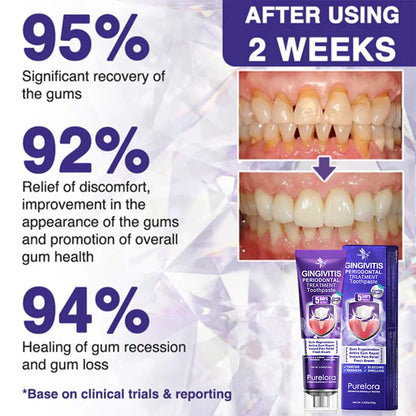 Purelora® VioCore Bee Venom Gingivitis & Periodontitis Treatment Toothpaste