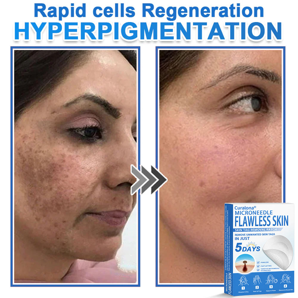 🔥 Curalona® 2-in-1 Microneedle & Hydrocolloid Patch | Raised Moles,Acne,  Flat Warts & Skin Tags Remover | Improves Wrinkles, Scars & Blemishes | Invisible Pimple Patches for Face & Body