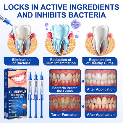 🏅🦷🛡️Purelora® GumRevive Periodontal Repair Gel