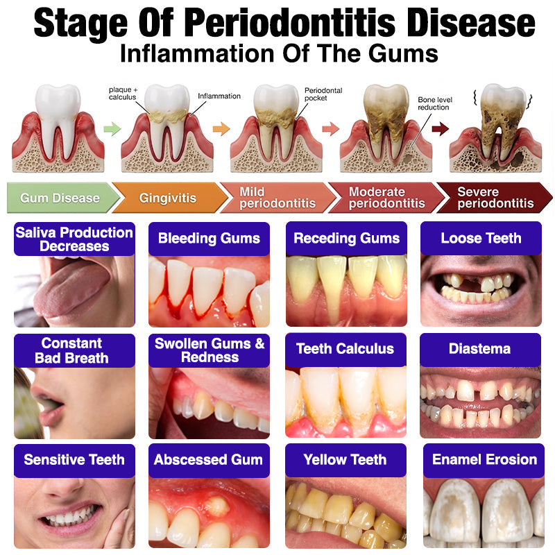 Purelora® VioCore Bee Venom Gingivitis & Periodontitis Treatment Toothpaste